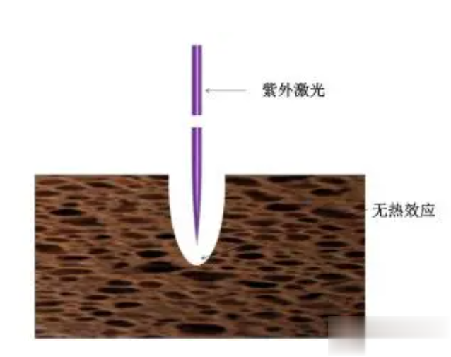 激光打標(biāo)機(jī)冷加工和熱加工怎么選(圖2)